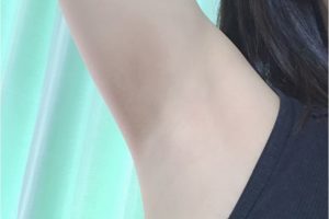 脱毛ワキ
