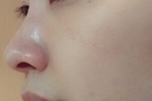 アルビオン保湿