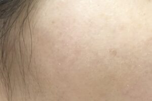 pola-whiteshotビフォーアフター