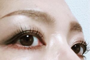 エグータムビフォーアフター