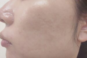 インテグレート崩れにくさ