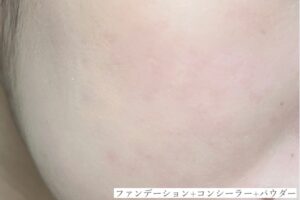 ランコムおすすめ３