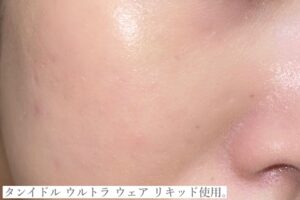 ランコムカバー力