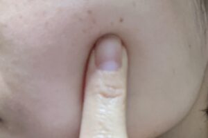 laboビフォーアフター