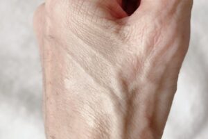 aplin崩れにくさ