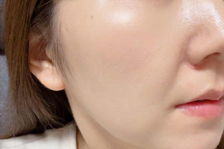 orbis崩れにくさ