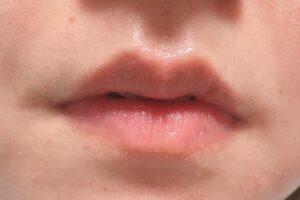 romandおすすめの使い方3