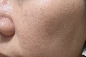 esteelauderカバー力