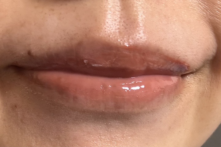 hera保湿力